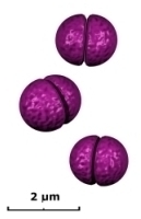 gram negative diplococci